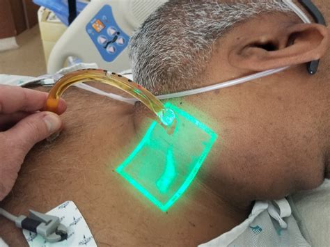 patient  jugular venous distension vein finderenhanced