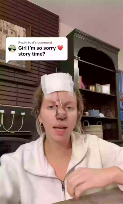 Woman reveals horrific injuries after beloved dog of 11 years bites her