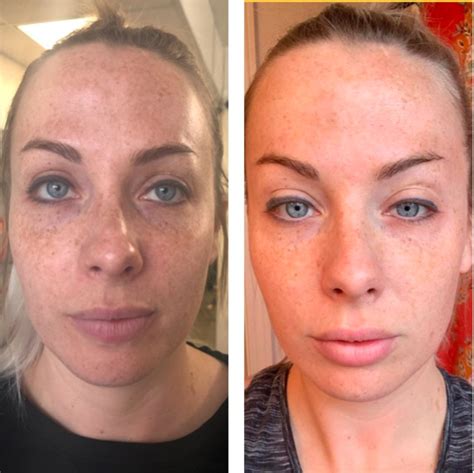 Souirensu It Works: My Before & After Photos Will Blow You Away! - xrye819