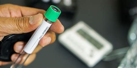 Kompletna krvna slika | vasezdravlje.com