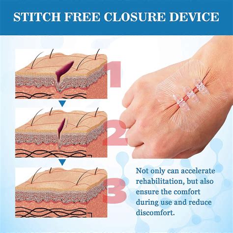 Wound Closure Strips, Emergency Wound Closure Device, Butterfly