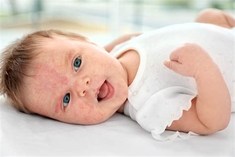 Challenging Pediatric Dermatology Cases: What's the Diagnosis?