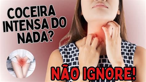 Coceira Nas Nádegas O Que Pode Ser - COCEIRA NO CORPO 'DO NADA'? SAIBA O QUE PODE SER | Dr Dayan Siebra ...