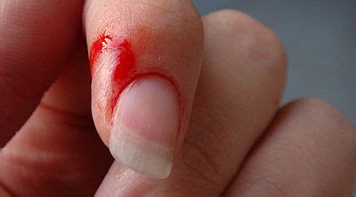 presurfer   paper cuts hurt