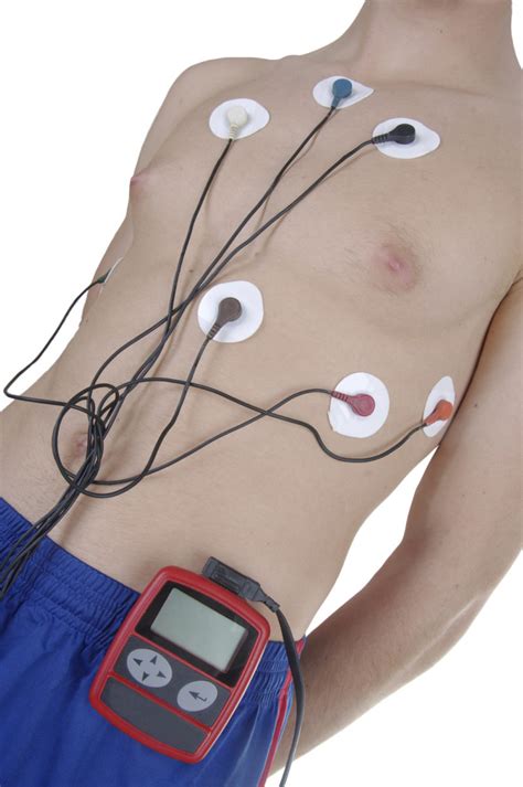 hour holter monitor cardiac diagnostic services