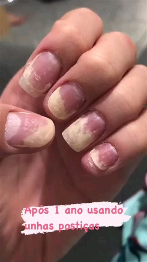 Unhas Fracas O Que Fazer - Pin em Unhas