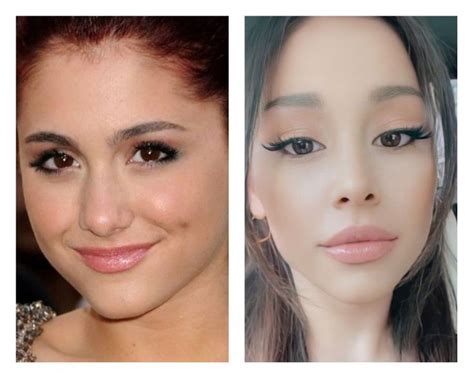 Nosejob LipfillersBotox Nose Job, Plastic Surgery, Ariana Grande ...