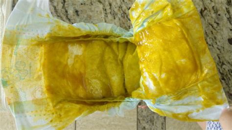 Coco De Bebe De 1 Mes - Minha Sofia de 1 mês está fazendo coco amarelo é muito agoado | BabyCenter