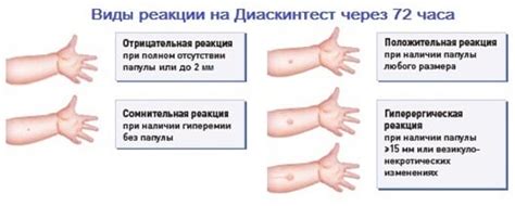 Положительный результат диаскинтеста: фото, причины, что делать?