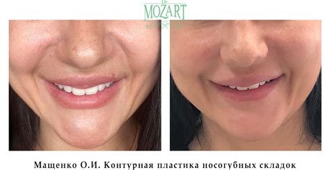 Косметология - фото до и после процедур в Одессе и Украине