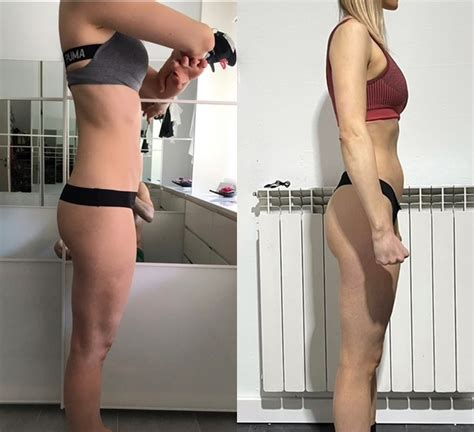 Fili Sospensione Glutei Prima E Dopo 4