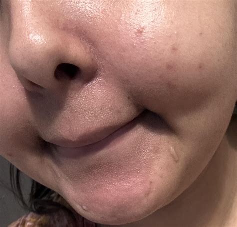 Please help me fix my skin ;( : r/koreanskincare