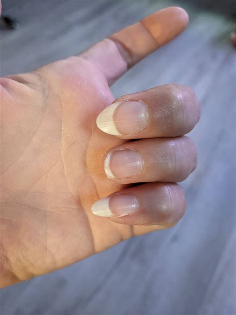 Whelp my nail ripped off and I have no idea when, where, or how. I just