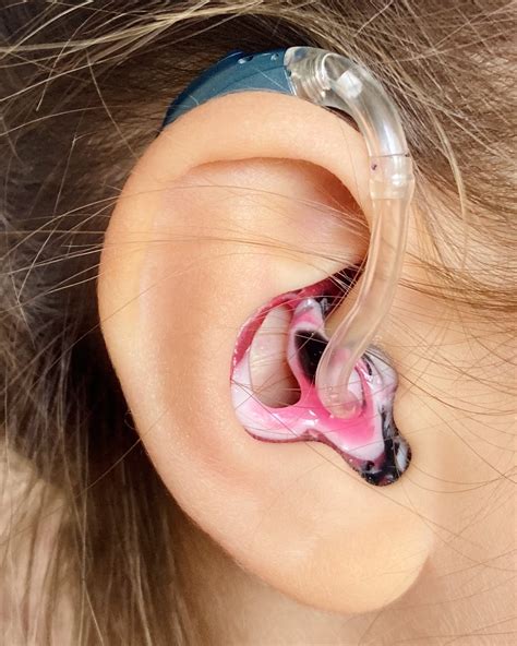 Miracle ear app updates improve hearing aid clarity for thousands 9