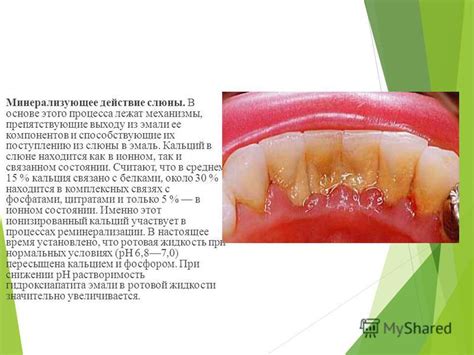 Презентация на тему: "Слюна, Ротовая жидкость. Состав, функции ...