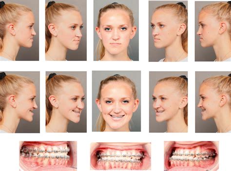 virtual surgical planning  blueprint  construction clinical