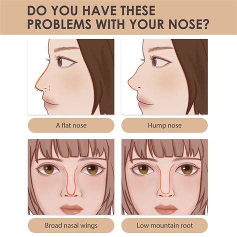 Top N Shop BD - Nose Slim Lifting Serum Oil