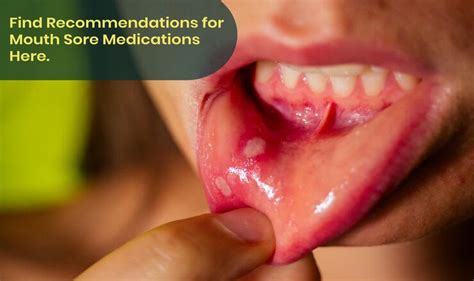 how to fix a sore mouth