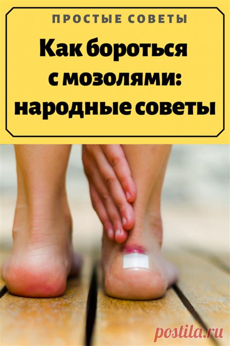 Как бороться с мозолями: народные советы.Мозоли — утолщения кожи в ме ...