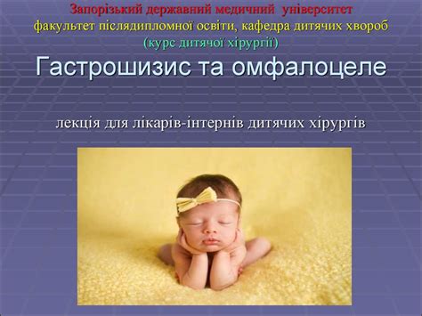 Гастрошизис и омфалоцеле - презентация онлайн
