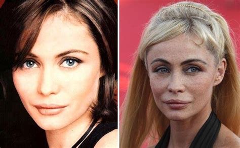 Emmanuelle Beart Avant Chirurgie