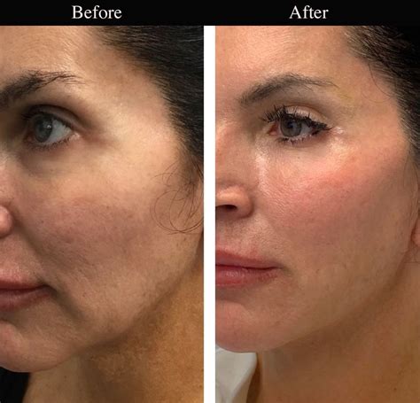 thread lifting headington nhs dental practice oxford cowley