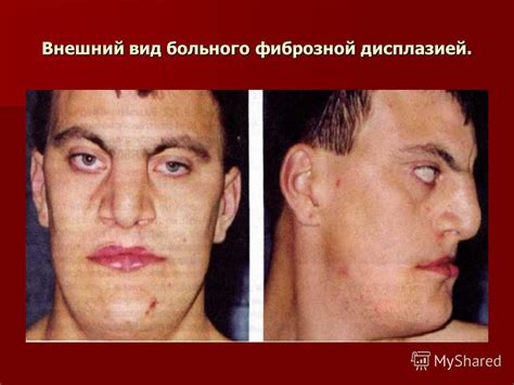 Презентация на тему: "Лекция по хирургической стоматологии на тему ...
