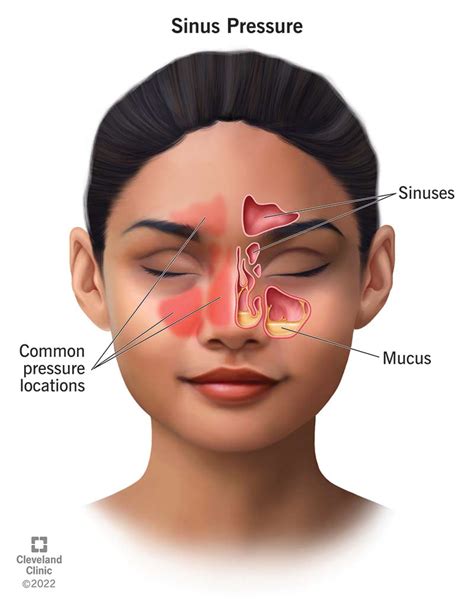 Sinus Pressure: Causes and How To Find Relief