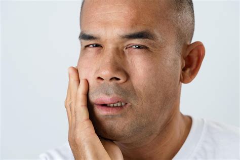 The man has facial swelling due to an allergic reaction to triggers