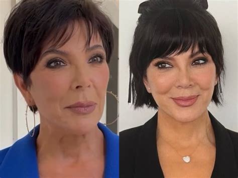 Mae Das Kardashians Antes E Depois - Mãe das Kardashians teria buscado “mestre do lifting facial” para ...