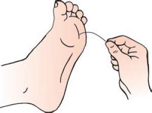 Diabetic Monofilament Tests | Medline Industries, Inc.