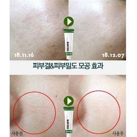 Кремы для проблемной кожи - Cica Antio Cream [MEDI-PEEL] | bb-mania.kz