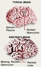 THE REAL GENIUS OF ALBERT EINSTEIN'S BRAIN - Dying Words