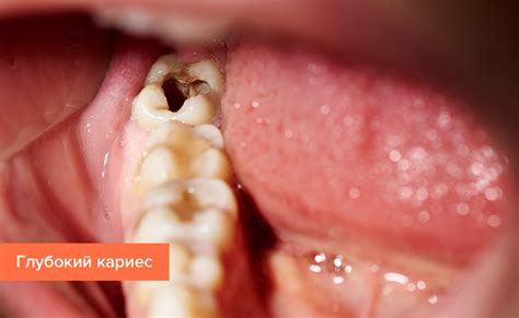 расположение и название зубов у человека