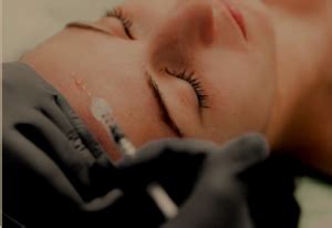 PLINEST Polynucleotides | Anti-Ageing Aesthetics