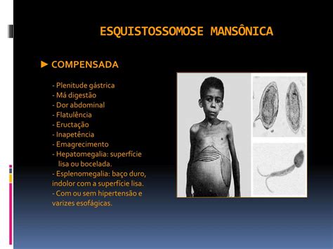 PPT - Esquistossomose mansônica PowerPoint Presentation, free download ...