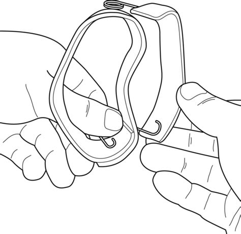 Guide Functional ulnar nerve splint and combined ulnar median nerve splint