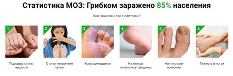 Экзин – мазь против грибка: отзывы, цена, развод или нет?