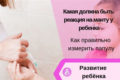 Реакція манту: розміри, норма у дітей 1 року