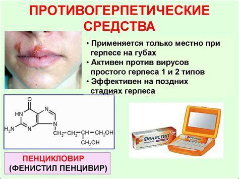 Противовирусные средства - презентация онлайн