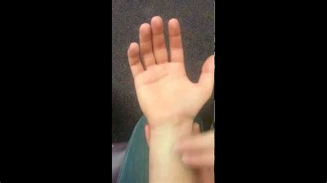 Tinel's Test - YouTube