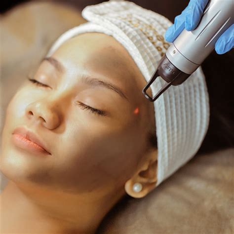Crystal Carbon Peel Laser | Southeast Dermatology