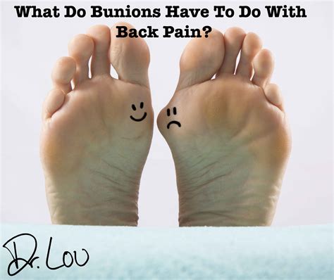 Are Your Bunions Related To Back Pain And Spinal Degeneration? - Jacobs