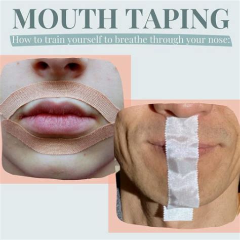 mouth tape family dental centre