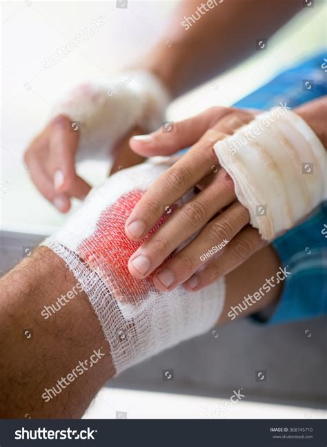 bad scrape  leg images stock  vectors shutterstock