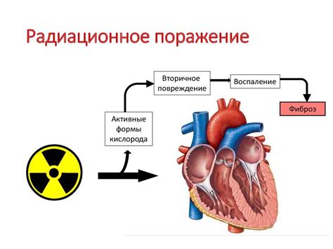 Рестриктивная кардиомиопатия - презентация онлайн