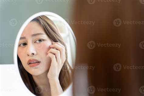 woman asian are worried about faces Dermatology and allergic to