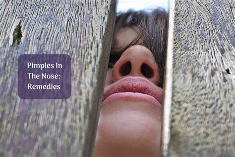 Pimple In The Nose? Here's How You Can Fix The Problem!