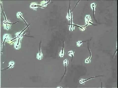 Astenozoospermia - YouTube