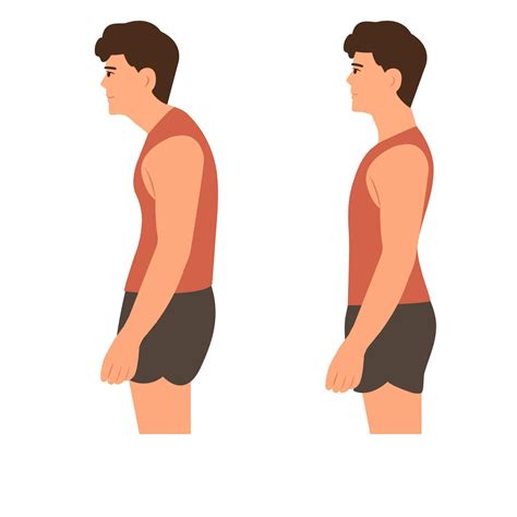 Correct and incorrect standing posture.Cervical spinal curvature. Hump